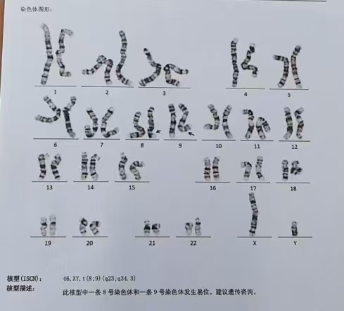 染色体平衡易位.jpg